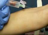 Phlebotomy Draw on demand...